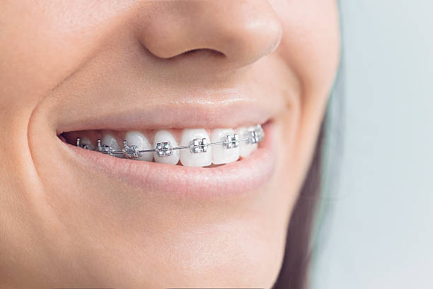 Best Full Mouth Reconstruction  in Bartonsville, MD